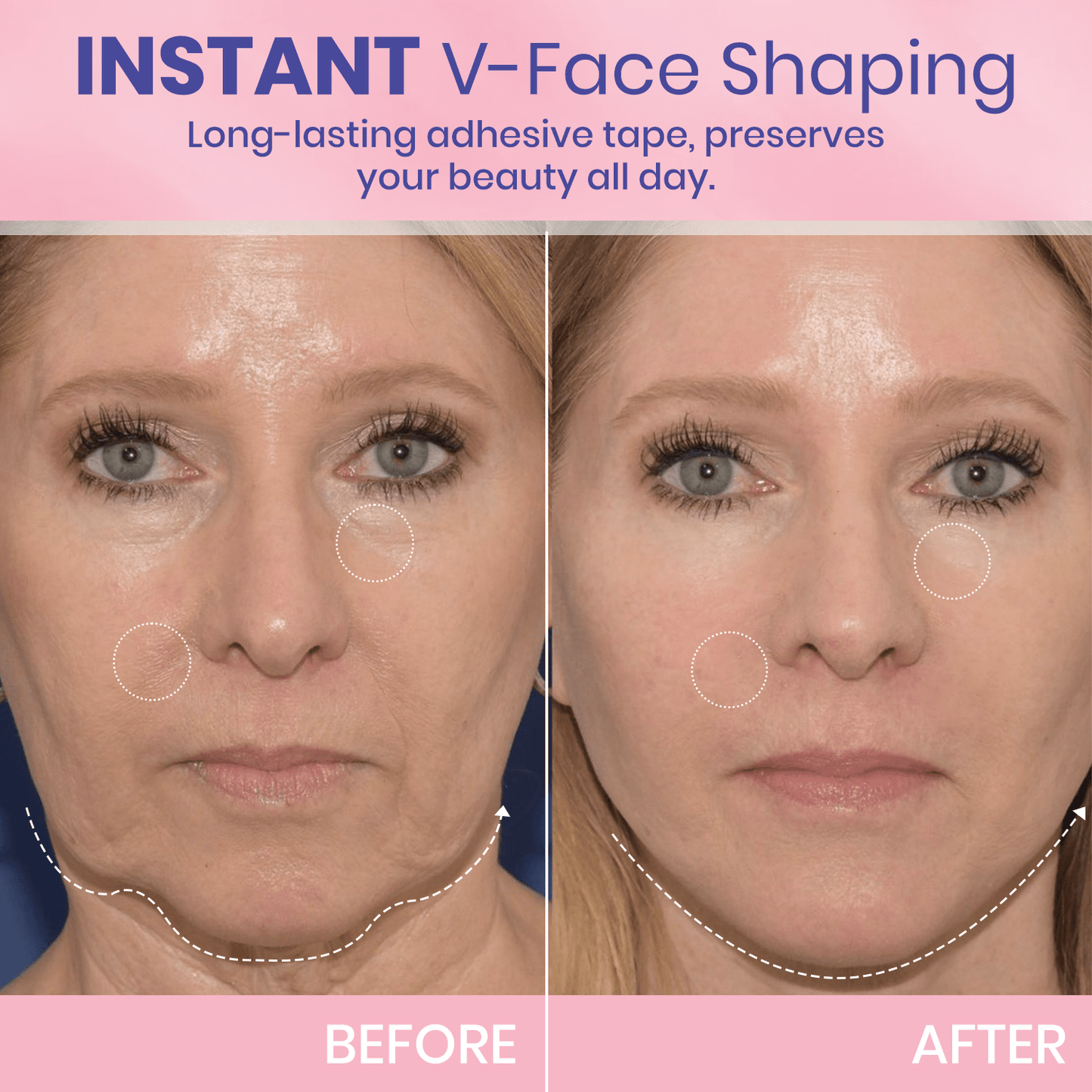 Instant V-Shape Face Tape