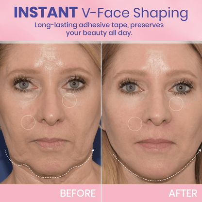 Instant V-Shape Face Tape