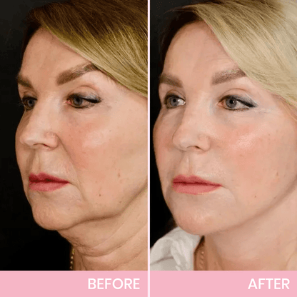 Instant V-Shape Face Tape