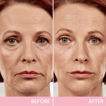 Instant V-Shape Face Tape